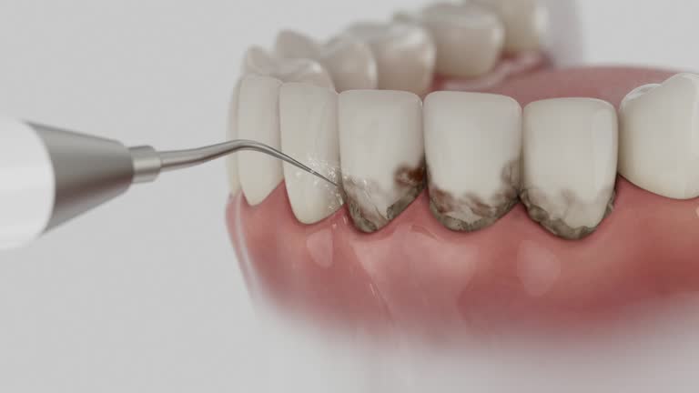 Reliable Teeth Cleaning And Checkup contractor in Warren County County, IA by Dentist Open Now